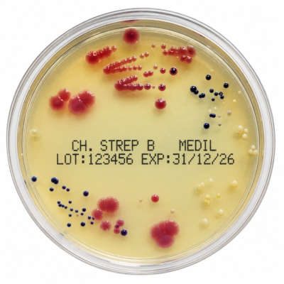 CHROMOGENIC-STREP-B-90mm-Medil